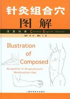 Illustrations of Composed Acupoints in Acupuncture-Moxibustion Use - Chinese and English Edition